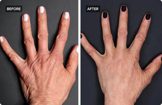 Juno Anti-Wrinkle Hand Serum