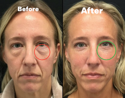 JunoYouth Instant Eye Firming Serum
