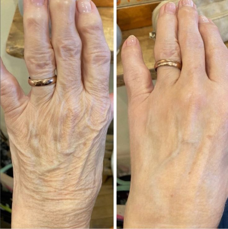 Juno Anti-Wrinkle Hand Serum